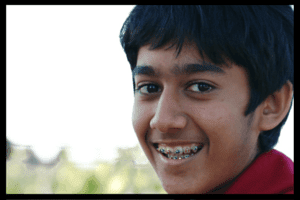 Orthodontics for Children